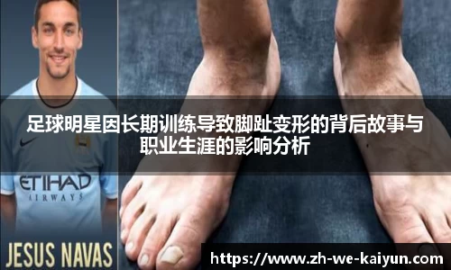 足球明星因长期训练导致脚趾变形的背后故事与职业生涯的影响分析